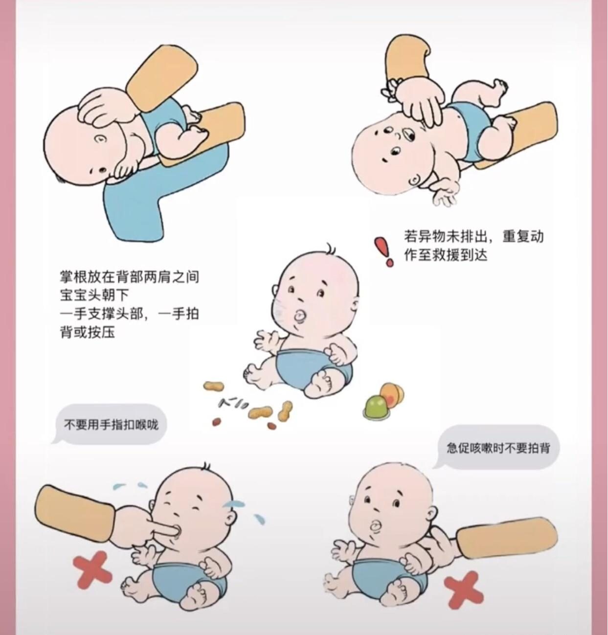 这些意外,如何急救